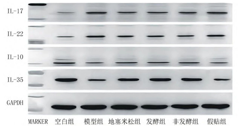 空白組和支氣管哮喘各組大鼠肺組織中IL－17、IL－22、IL－10、IL－35蛋白表達(dá)電泳圖